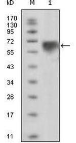 TYRO3 Monoclonal Antibody (10E11)