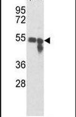 Tyrosinase Antibody in Western Blot (WB)