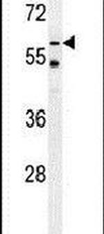 TYSND1 Antibody in Western Blot (WB)