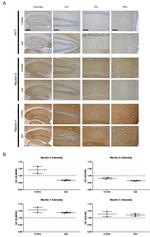 Tau Antibody in Immunohistochemistry (IHC)