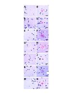 Phospho-Tau (Ser202, Thr205) Antibody in Immunohistochemistry (IHC)