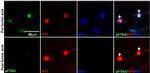 Tau Antibody in Immunocytochemistry (ICC/IF)