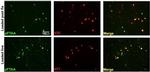 Tau Antibody in Immunocytochemistry (ICC/IF)