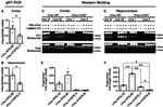 Tau Antibody in Western Blot (WB)