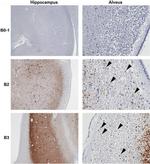 Phospho-Tau (Ser202, Thr205) Antibody in Immunohistochemistry (IHC)