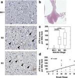 Phospho-Tau (Ser202, Thr205) Antibody in Immunohistochemistry (IHC)