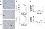 Phospho-Tau (Ser202, Thr205) Antibody in Immunohistochemistry (IHC)