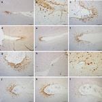Phospho-Tau (Ser202, Thr205) Antibody in Immunohistochemistry (IHC)