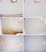 Phospho-Tau (Ser202, Thr205) Antibody in Immunohistochemistry (IHC)