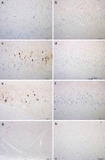 Phospho-Tau (Ser202, Thr205) Antibody in Immunohistochemistry (IHC)