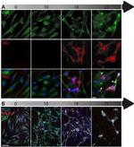 Tau Antibody in Immunocytochemistry (ICC/IF)