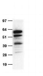 Tdtomato Antibody in Western Blot (WB)
