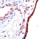 TGF beta-1 Antibody in Immunohistochemistry (IHC)