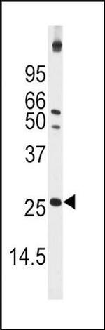 Thioredoxin 2 Antibody in Western Blot (WB)
