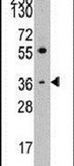 Thrombopoietin Antibody in Western Blot (WB)
