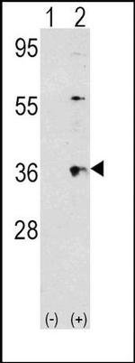 Thrombopoietin Antibody in Western Blot (WB)
