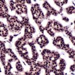 Thymidylate Synthase Antibody in Immunohistochemistry (IHC)