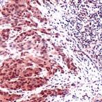 Thymidylate Synthase Antibody in Immunohistochemistry (IHC)