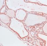 THRA Antibody in Immunohistochemistry (IHC)