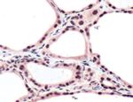 THRB Antibody in Immunohistochemistry (IHC)