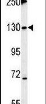 Tankyrase 2 Antibody in Western Blot (WB)