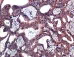 TOP1 Antibody in Immunohistochemistry (IHC)