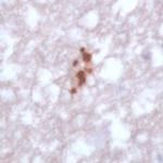 Toxoplasma Gondii Antibody in Immunohistochemistry (IHC)