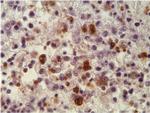 Toxoplasma gondii Antibody in Immunohistochemistry (IHC)