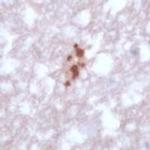 Toxoplasma gondii Antibody in Immunohistochemistry (IHC)