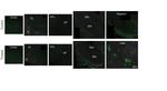 Transferrin Receptor Antibody in Immunohistochemistry (IHC)