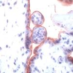 TGFBR1 Antibody in Immunohistochemistry (Paraffin) (IHC (P))