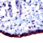 TGFBR3 Antibody in Immunohistochemistry (IHC)