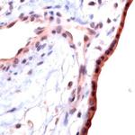 TGFBR1 Antibody in Immunohistochemistry (IHC)