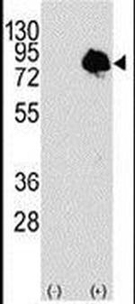 TGM2 Antibody in Western Blot (WB)