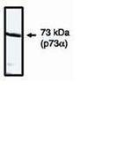 p73 Polyclonal Antibody
