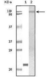 TYK2 Monoclonal Antibody (8G8E9, 8G9H5,8G8B3)