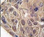 YARS Antibody in Immunohistochemistry (IHC)