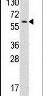 YARS Antibody in Western Blot (WB)
