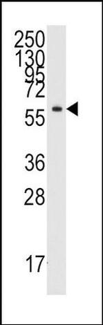 YARS Antibody in Western Blot (WB)