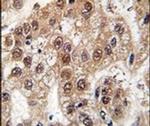 U2AF1 Antibody in Immunohistochemistry (IHC)