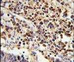 U2AF1 Antibody in Immunohistochemistry (IHC)