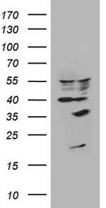 U2AF1L4 Antibody in Western Blot (WB)