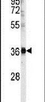 U2AF1 Antibody in Western Blot (WB)