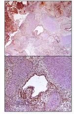 SR140 Antibody in Immunohistochemistry (IHC)