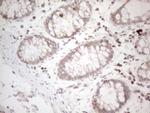 UBA52 Antibody in Immunohistochemistry (Paraffin) (IHC (P))