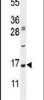 UBA52 Antibody in Western Blot (WB)