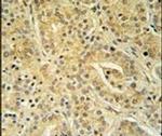 UBAC1 Antibody in Immunohistochemistry (IHC)