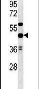 UBAC1 Antibody in Western Blot (WB)