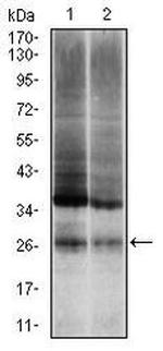 Ubiquitin B Monoclonal Antibody (3C12)