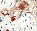 UBC9 Antibody in Immunohistochemistry (IHC)